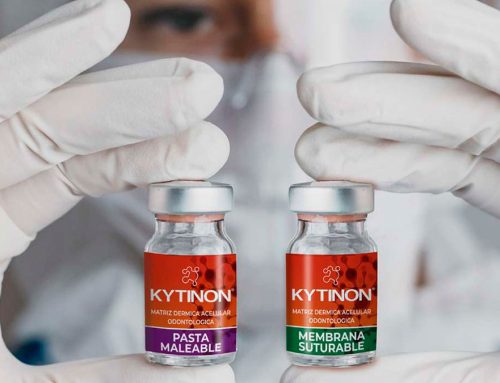 Kytinon en el consultorio odontológico